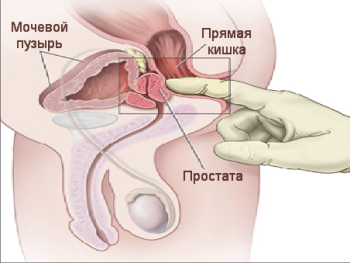 Массаж простаты